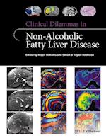 Clinical Dilemmas in Non–Alcoholic Fatty Liver Disease
