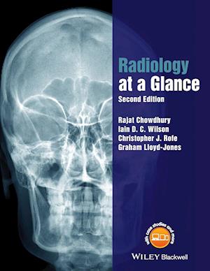 Radiology at a Glance 2e