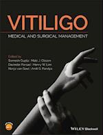 Vitiligo – Medical and Surgical Management