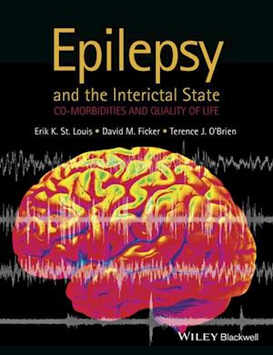 Epilepsy and the Interictal State