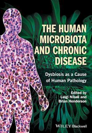 The Human Microbiota and Chronic Disease – Dysbiosis as a Cause of Human Pathology