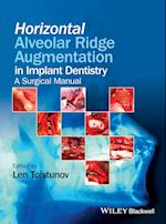 Horizontal Alveolar Ridge Augmentation in Implant Dentistry