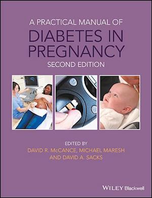 A Practical Manual of Diabetes in Pregnancy 2e