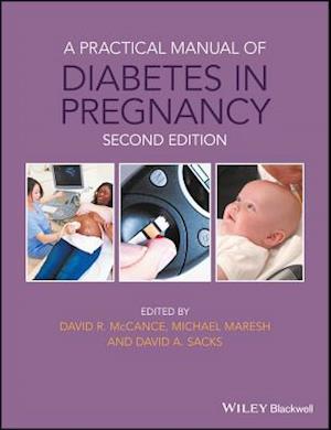 Practical Manual of Diabetes in Pregnancy