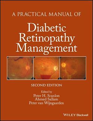 A Practical Manual of Diabetic Retinopathy Management 2e
