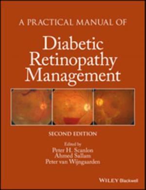 Practical Manual of Diabetic Retinopathy Management