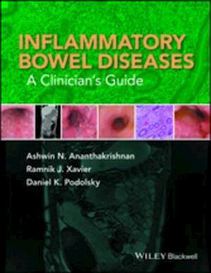 Inflammatory Bowel Diseases