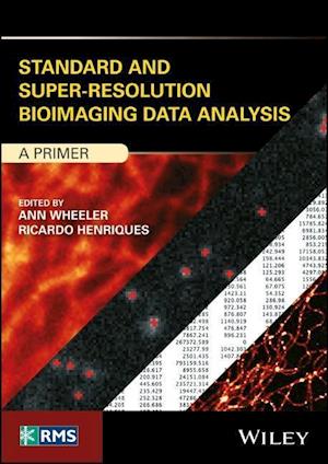 Standard and Super–Resolution Bioimaging Data Analysis – A Primer
