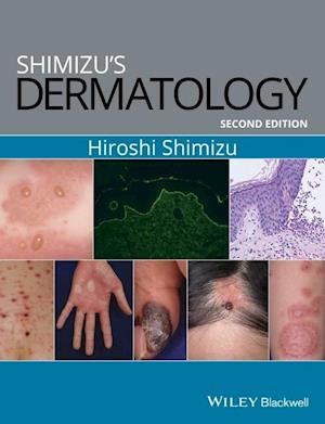 Shimizu's Dermatology, 2e