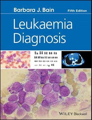 Leukaemia Diagnosis