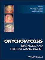 Onychomycosis – Diagnosis and Effective Management