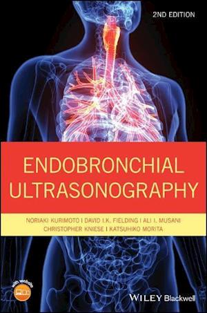 Endobronchial Ultrasonography 2e