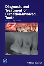 Diagnosis and Treatment of Furcation-Involved Teeth