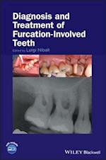 Diagnosis and Treatment of Furcation-Involved Teeth