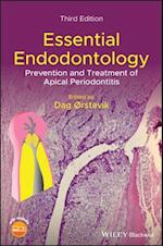 Essential Endodontology – Prevention and Treatment of Apical Periodontitis, 3rd Edition