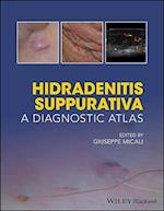 Hidradenitis Suppurativa – A Diagnostic Atlas
