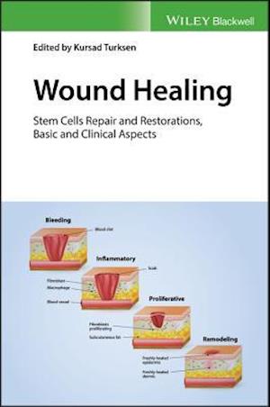 Wound Healing