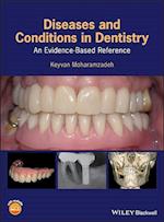Diseases and Conditions in Dentistry – An Evidence–Based Reference