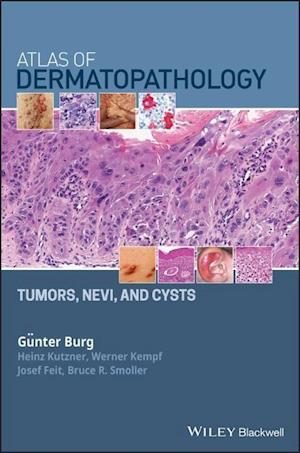Atlas of Dermatopathology Tumors, Nevi, and Cysts