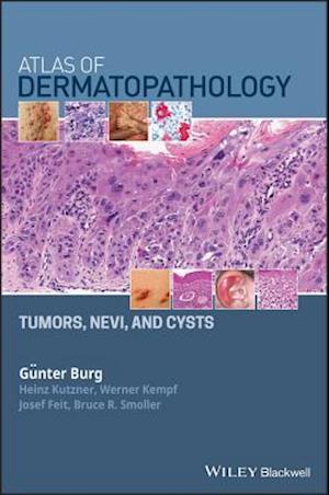 Atlas of Dermatopathology