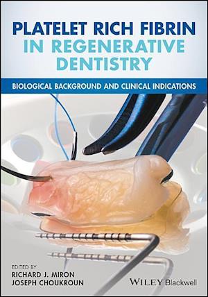 Platelet Rich Fibrin in Regenerative Dentistry – Biological Background and Clinical Indications