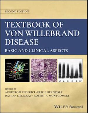 Textbook of Von Willebrand Disease