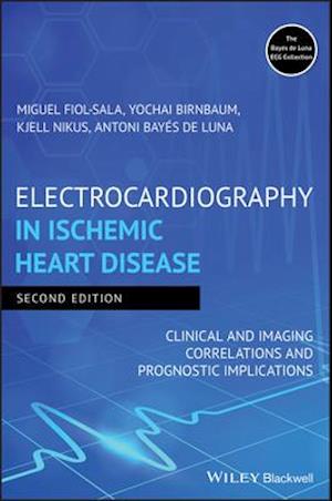 Electrocardiography in Ischemic Heart Disease