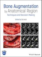 Bone Augmentation by Anatomical Region