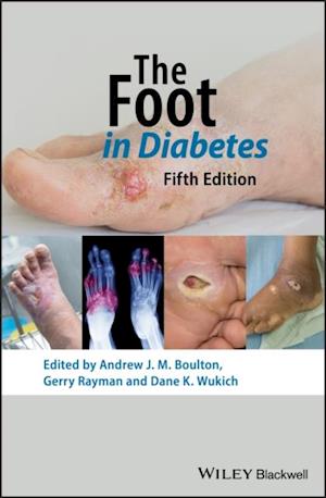 Foot in Diabetes