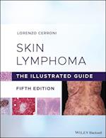 Skin Lymphoma – The Illustrated Guide