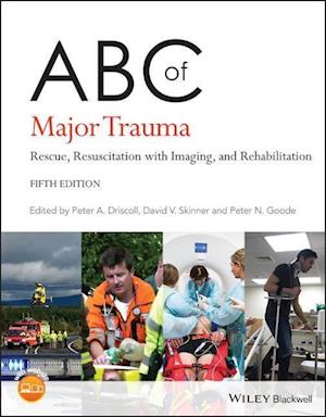 ABC of Major Trauma