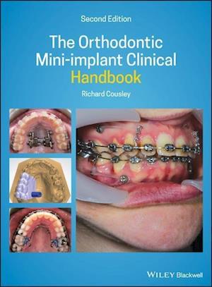 The Orthodontic Mini-implant Clinical Handbook