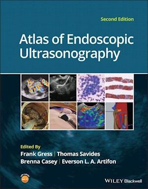 Atlas of Endoscopic Ultrasonography