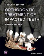 Orthodontic Treatment of Impacted Teeth