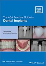 ADA Practical Guide to Dental Implants