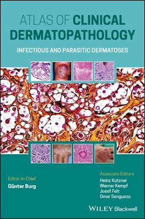 Atlas of Clinical Dermatopathology