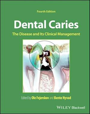 Dental Caries