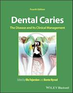 Dental Caries