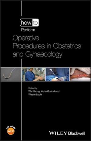 How to Perform Operative Procedures in Obstetrics and Gynaecology