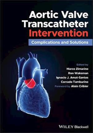 Aortic Valve Transcatheter Intervention – Complications and Solutions