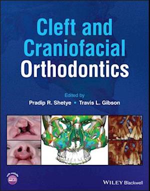 Cleft and Craniofacial Orthodontics