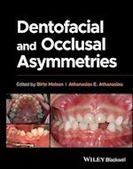 Dentofacial and Occlusal Asymmetries