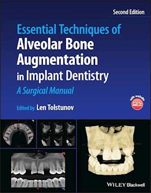 Essential Techniques of Alveolar Bone Augmentation in Implant Dentistry