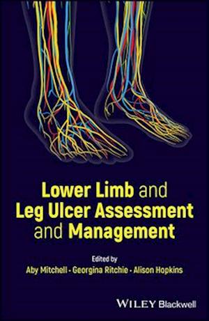 Lower Limb and Leg Ulcer Assessment and Management