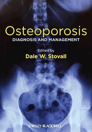 Osteoporosis – Diagnosis and Management