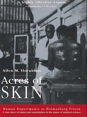 Acres of Skin