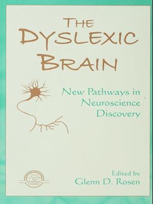 Dyslexic Brain