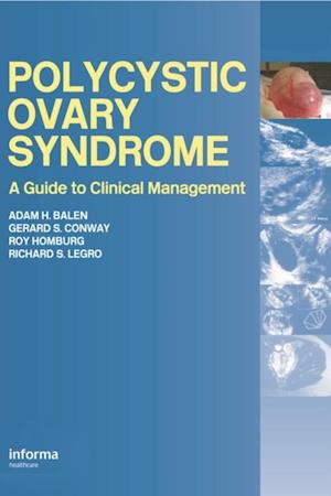 Polycystic Ovary Syndrome