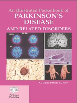 An Illustrated Pocketbook of Parkinson''s Disease and Related Disorders