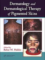 Dermatology and Dermatological Therapy of Pigmented Skins